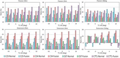 Biomechanical influence of T1 tilt alteration on adjacent segments after anterior cervical fusion